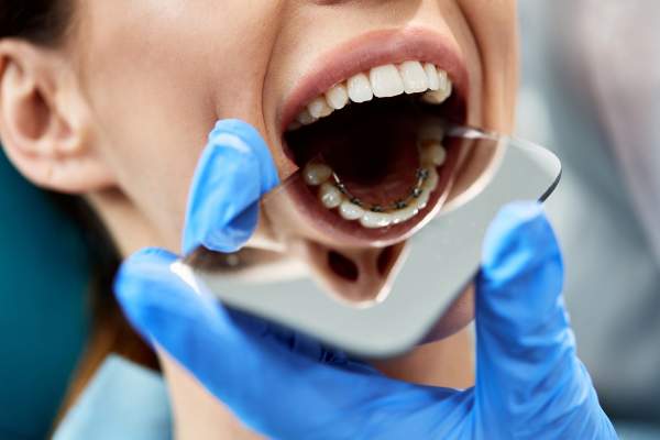 Gripzakjes voor orthodontiepraktijken